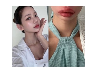 맹승지 입술 필러로 외모 바꾼 건가?
