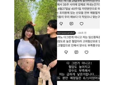 최연수 2kg 대 아들 출산 소식 전해져