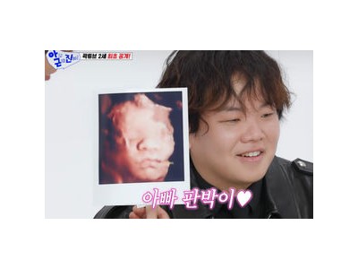 곽튜브 2세 예비 아빠로 변신 초음파 사진 공개